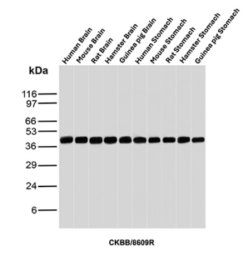 Creatine Phosphokinase BB Antibody Human Mouse Rat Hamster Guinea Pig Brain and Stomach WB. Western blot analysis of human brain, mouse brain, rat brain, hamster brain, guinea pig brain, human stomach, mouse stomach, rat stomach, hamster stomach, and guinea pig stomach tissue lysates using Creatine Phosphokinase BB antibody. The recombinant rabbit monoclonal antibody clone CKBB/8609R detects a band at approximately 43 kDa, consistent with the predicted molecular weight of Creatine kinase B / CKB. The consistent banding across species and tissues supports detection of the CK-BB isoenzyme, highlighting its conserved expression profile and enabling isoenzyme-focused analysis in western blot studies.