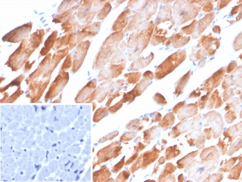 TPM1 Antibody Human Heart IHC. Immunohistochemical staining of FFPE human heart tissue using TPM1 Antibody / Muscle Contractile Protein Antibody (clone TPM1/4510) demonstrates strong cytoplasmic HRP-DAB brown staining throughout cardiomyocytes. The staining pattern is consistent with expression of TPM1 (Tropomyosin Alpha-1 Chain), a major actin-binding protein of the sarcomeric thin filament that regulates actin-myosin interactions and contributes to cardiac muscle contraction. Robust immunoreactivity within cardiac muscle fibers highlights the essential role of TPM1 in sarcomere organization, myocardial contractility, and maintenance of normal heart function. The inset shows a negative control section in which PBS was used in place of the primary antibody, confirming staining specificity. HIER: boil tissue sections in pH 9, 10mM Tris with 1mM EDTA for 20 min and allow to cool before testing.