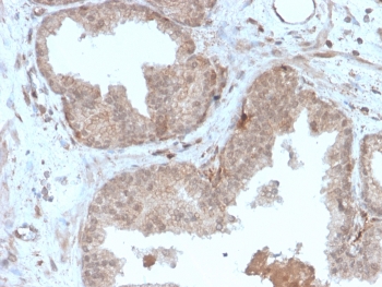MVP Antibody Prostate IHC. Immunohistochemistry analysis of Major Vault Protein (MVP / LRP) expression in FFPE human prostate tissue using clone r1032 recombinant mouse monoclonal antibody. Glandular epithelial cells exhibit moderate cytoplasmic HRP-DAB brown staining with a diffuse to finely granular pattern, while surrounding stromal cells show minimal background signal. The staining highlights luminal epithelial structures and intracellular distribution consistent with the role of Major vault protein in intracellular transport and signaling regulation. Heat-induced epitope retrieval was performed in pH 9 10mM Tris with 1mM EDTA for 20 minutes followed by cooling prior to antibody incubation.
