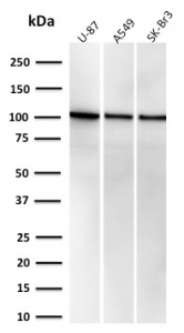 MVP Antibody WB. Western blot analysis of Major Vault Protein (MVP / LRP) expression in human cell lysates using clone r1032 recombinant mouse monoclonal antibody. Lane 1: U-87 lysate, Lane 2: A549 lysate, Lane 3: SK-BR-3 lysate. A band is detected at approximately 104-110 kDa, consistent with the predicted molecular weight of Major vault protein. The consistent band intensity across multiple epithelial-derived cell lines supports reliable detection of MVP as a key regulator of intracellular transport and signaling pathways.