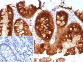 Estrogen Inducible Protein pS2 Antibody C-Terminus. Immunohistochemistry analysis of Trefoil factor 1 (TFF1) in formalin-fixed, paraffin-embedded human colon tissue using Estrogen Inducible Protein pS2 Antibody C-Terminus clone TFF1/8817R. Glandular epithelial cells demonstrate HRP-DAB brown cytoplasmic staining consistent with expression of the estrogen regulated secretory peptide TFF1 (pS2). Hematoxylin counterstain highlights nuclei (blue). Antigen retrieval was performed by boiling tissue sections in pH 9 10mM Tris with 1mM EDTA for 20 min followed by cooling prior to immunohistochemistry staining. Inset: PBS was used in place of the primary antibody as a secondary antibody negative control.