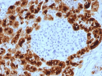 IHC staining of FFPE human pancreas tissue with Glycoprotein 2 antibody (clone GP2/3510). HIER: boil tissue sections in pH 9 10mM Tris with 1mM EDTA for 20 min and allow to cool before testing.
