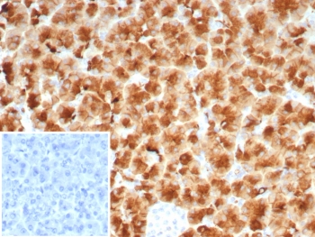 Immunohistochemistry analysis of GP2 antibody in human pancreas. GP2 Antibody Recombinant mouse MAb rGP2/8617 was used for immunohistochemistry on FFPE human pancreas tissue. Strong HRP-DAB brown cytoplasmic and apical staining is observed in pancreatic acinar epithelial cells, consistent with the known localization of Glycoprotein 2 (GP2) to pancreatic zymogen granule membranes in exocrine pancreas. The staining highlights secretory acinar cell clusters, while surrounding stromal regions show minimal signal. Inset: PBS used in place of primary antibody as a secondary antibody negative control. HIER: boil tissue sections in pH 9 10mM Tris with 1mM EDTA for 20 min and allow to cool before testing.