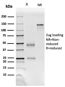 SDS-PAGE analysis of purified, BSA-free SMMHC antibody (clone SM-M10) as confirmation of integrity and purity.