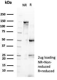 SDS-PAGE analysis of purified, BSA-free recombinant MYH11 antibody (clone rMYH11/8066) as confirmation of integrity and purity.