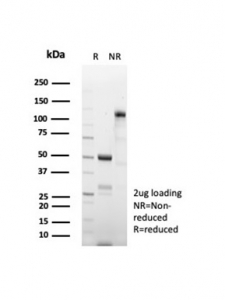 SDS-PAGE analysis of purified, BSA-free CD269 antibody (clone CD269/8508R) as confirmation of integrity and purity.