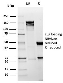 SDS-PAGE analysis of purified, BSA-free Mesothelin antibody rabbit monoclonal (clone MSLN/6443R) as confirmation of integrity and purity.