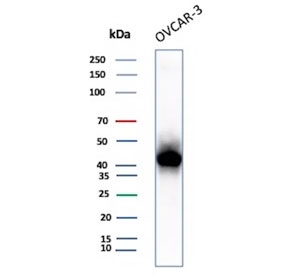 MSLN Antibody for WB. Western blot analysis of MSLN antibody in human OVCAR-3 cell lysate. The recombinant mouse mAb clone rMSLN/8764 detects a prominent band at approximately 40 kDa, consistent with the processed mature Mesothelin form generated by proteolytic cleavage of the precursor protein. The predicted molecular weight of the full-length Mesothelin precursor is approximately 70 kDa, while the membrane-associated processed form is approximately 40 kDa. The observed band pattern in OVCAR-3 cells aligns with expected processing of Mesothelin in ovarian carcinoma-derived cell lines.