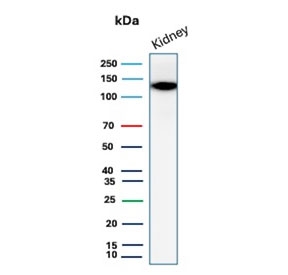 Western blot testing of human kidney tissue lysate with Cadherin 16 antibody. Expected molecular weight: 90~130 kDa.