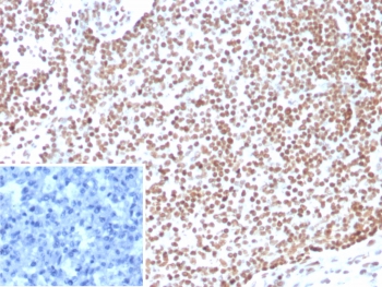 E2F4 Antibody Lymph Node IHC. Immunohistochemistry analysis of FFPE human lymph node tissue stained with E2F4 antibody detecting E2F transcription factor 4, clone E2F4/4224. Strong nuclear staining is observed in lymphoid cells, consistent with the role of E2F4 as a transcriptional regulator within the RB pathway controlling cell cycle progression and gene repression. The staining highlights dense lymphocyte populations, while stromal areas show comparatively reduced signal. The inset shows a PBS-only negative control processed without primary antibody, confirming minimal non-specific background staining. Hematoxylin counterstain highlights nuclei in blue. HIER: boil tissue sections in pH 9 10 mM Tris with 1 mM EDTA for 20 min and allow to cool before testing.