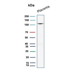 CDH1 Antibody for WB. Western blot analysis of Cadherin 1 / CDH1 expression in human placental tissue lysate using clone rCDH1/7352 antibody, showing a band consistent with the predicted molecular weight of E-cadherin. E-cadherin is synthesized as a precursor and undergoes glycosylation, resulting in an apparent molecular weight typically observed between approximately 80-120 kDa, with the precursor form near 135 kDa. The detected band aligns with mature glycosylated E-cadherin expressed in placental epithelial tissue.