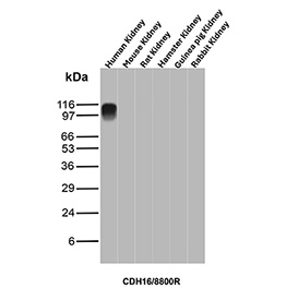 Ksp-Cadherin Antibody Human Kidney WB. Western blot analysis of Cadherin-16 / CDH16, also known as Ksp-Cadherin, expression across kidney tissue lysates from multiple species using Ksp-Cadherin antibody clone CDH16/8800R. Lane 1: human kidney lysate, Lane 2: mouse kidney lysate, Lane 3: rat kidney lysate, Lane 4: hamster kidney lysate, Lane 5: guinea pig kidney lysate, Lane 6: rabbit kidney lysate. A band is detected at approximately 95-110 kDa in human kidney lysate, consistent with the predicted molecular weight of Ksp-Cadherin (CDH16), with the slightly higher apparent migration reflecting glycosylation of this kidney-restricted adhesion protein. Minimal or no detectable signal is observed in the non-human kidney lysates under these conditions, supporting a human kidney-enriched detection profile for this clone.