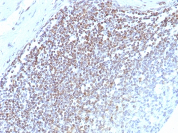 E2F4 Antibody Human Spleen IHC. Immunohistochemistry staining of FFPE human spleen tissue with E2F4 antibody (clone E2F4/8984R). HIER: boil tissue sections in pH 9 10mM Tris with 1mM EDTA for 20 min and allow to cool before testing.