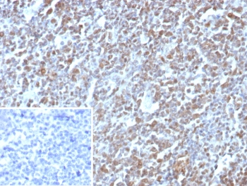 E2F4 Antibody Human Tonsil IHC. Immunohistochemistry staining of FFPE human tonsil tissue with E2F4 antibody (clone E2F4/8984R). Inset: PBS used in place of primary Ab (secondary Ab negative control). HIER: boil tissue sections in pH 9 10mM Tris with 1mM EDTA for 20 min and allow to cool before testing.