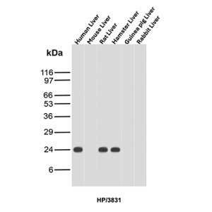 HP Antibody HP/3831 Detection Across Mammalian Liver Tissues WB. Western blot analysis of human, mouse, rat, hamster, guinea pig and rabbit liver tissue lysates using HP Antibody clone HP/3831. A prominent band is detected at approximately 24 kDa in human, rat and hamster liver, while little to no corresponding signal is evident in mouse, guinea pig or rabbit liver under the tested conditions. Haptoglobin is synthesized as an approximately 45 kDa precursor that undergoes proteolytic processing into alpha and beta chains; the observed ~24 kDa band is consistent with the processed haptoglobin beta chain, whose apparent molecular weight can be influenced by glycosylation.
