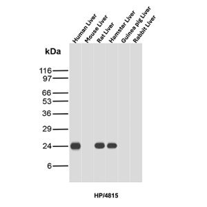 Haptoglobin Antibody HP/4815 Detection Across Mammalian Liver Tissues WB. Western blot analysis of human, mouse, rat, hamster, guinea pig and rabbit liver tissue lysates using Haptoglobin Antibody clone HP/4815. A prominent band is detected at approximately 24 kDa in human, rat and hamster liver, while little to no corresponding signal is evident in mouse, guinea pig or rabbit liver under the tested conditions. Haptoglobin is synthesized as an approximately 45 kDa precursor that undergoes proteolytic processing into alpha and beta chains; the observed ~24 kDa band is consistent with the processed haptoglobin beta chain, whose apparent molecular weight can be influenced by glycosylation.