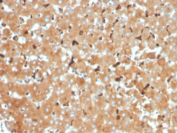 IHC staining of FFPE human liver tissue with Haptoglobin antibody (clone HP/3832). HIER: boil tissue sections in pH 9 10mM Tris with 1mM EDTA for 20 min and allow to cool before testing.