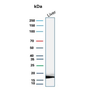 Haptoglobin Antibody HP/3834 Detection in Human Liver WB. Western blot analysis of human liver tissue lysate using Haptoglobin Antibody clone HP/3834. A strong, discrete band is detected at approximately 18 kDa. Haptoglobin is synthesized as an approximately 45-50 kDa precursor that undergoes proteolytic processing into alpha and beta chains; the observed ~18 kDa band is consistent with a processed haptoglobin chain.