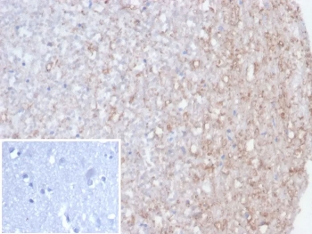 IHC staining of FFPE human brain tissue with recombinant CALB2 antibody (clone rCALB2/7123). Inset: PBS instead of primary (secondary negative control). HIER: boil tissue sections in pH 9 10mM Tris with 1mM EDTA for 20 min and allow to cool before testing.