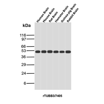 TUBB3 Antibody Multi-Species Brain WB. Western blot analysis of Beta III tubulin (TUBB3) expression across brain lysates from multiple species using TUBB3 antibody clone rTUBB3/7405. Lane 1: human brain lysate, Lane 2: mouse brain lysate, Lane 3: rat brain lysate, Lane 4: hamster brain lysate, Lane 5: guinea pig brain lysate, Lane 6: rabbit brain lysate. A band is detected at approximately 50â55 kDa, consistent with the predicted molecular weight of TUBB3, a neuron-specific microtubule protein. The consistent signal across species supports the use of this clone for cross-species neural tissue analysis.