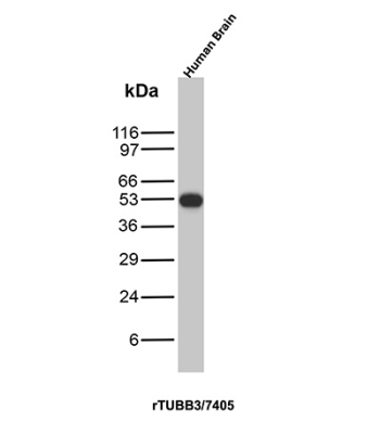 TUBB3 Antibody Human Brain WB. Western blot analysis of Beta III tubulin (TUBB3) expression in human brain tissue lysate using TUBB3 antibody clone rTUBB3/7405. Lane 1: human brain lysate. A band is detected at approximately 50â55 kDa, consistent with the predicted molecular weight of TUBB3. The clear detection supports the use of this clone for western blot analysis of neuronal tissues.
