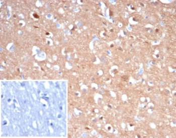 TUBB3 Antibody Brain IHC. Immunohistochemical analysis of Beta III tubulin (TUBB3) in formalin-fixed, paraffin-embedded human brain tissue using TUBB3 antibody clone rTUBB3/7405. Strong cytoplasmic staining is observed in neuronal cells and neuropil, consistent with the role of TUBB3 as a neuron-specific microtubule protein. The staining pattern highlights neuronal morphology and supports its use as a neuronal marker. Inset: PBS used in place of primary antibody serves as a negative control for secondary antibody binding.