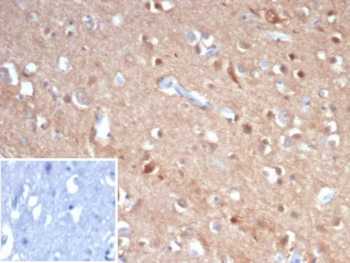 TUBB3 Antibody Neural Tissue IHC. Immunohistochemical analysis of Beta III tubulin (TUBB3) in formalin-fixed, paraffin-embedded human brain tissue using TUBB3 antibody clone rTUBB3/7406. Strong cytoplasmic staining is observed in neuronal cells and neuropil, consistent with TUBB3 localization in neuronal microtubules. The staining pattern supports its use in tissue-based detection of neural structures. Inset: PBS used in place of primary antibody serves as a negative control for secondary antibody binding.