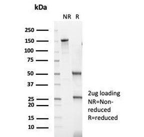 SDS-PAGE analysis of purified, BSA-free Cytokeratin 14 antibody (clone KRT14/6962) as confirmation of integrity and purity.