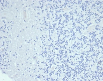 Negative control: IHC testing of FFPE human brain tissue with Cytokeratin 14 antibody (clone KRT14/6987R) at 2ug/ml. HIER: boil tissue sections in pH 9 10mM Tris with 1mM EDTA for 20 min and allow to cool before testing.
