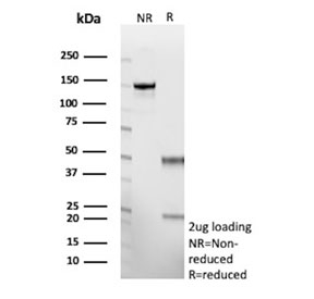 SDS-PAGE analysis of purified, BSA-free recombinant YWHAE antibody (clone rYWHAE/8860) as confirmation of integrity and purity.