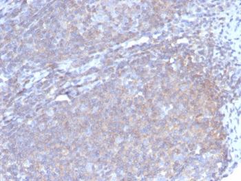 Granulocyte-Colony Stimulating Factor Antibody Lymph Node Immunohistochemistry. IHC analysis of FFPE human lymph node tissue with G-CSF antibody (clone CSF3/4597). HIER: boil tissue sections in pH 9 10mM Tris with 1mM EDTA for 20 min and allow to cool before testing.