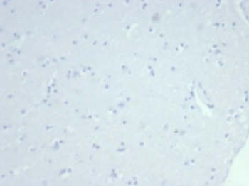 Negative control: IHC testing of FFPE human brain tissue using recombinant KRT14 antibody (clone rKRT14/7368) at 2ug/ml. HIER: boil tissue sections in pH 9 10mM Tris with 1mM EDTA for 20 min and allow to cool before testing.
