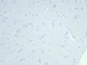 Negative control: IHC testing of FFPE human brain tissue using recombinant KRT14 antibody (clone rKRT14/7368) at 2ug/ml. HIER: boil tissue sections in pH 9 10mM Tris with 1mM EDTA for 20 min and allow to cool before testing.
