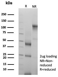 SDS-PAGE analysis of purified, BSA-free Acidic Cytokeratin antibody (clone rKRTL/8751) as confirmation of integrity and purity.