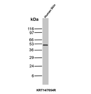 Western blot testing of human skin tissue lysate with Cytokeratin 14 Antibody KRT14/7054R. Predicted molecular weight ~53 kDa.