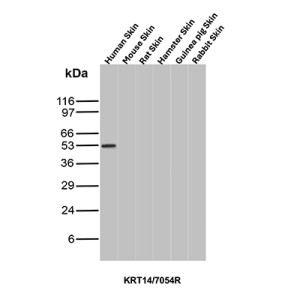 Western blot analysis of skin tissue lysates of different species using Cytokeratin 14 Antibody KRT14/7054R.