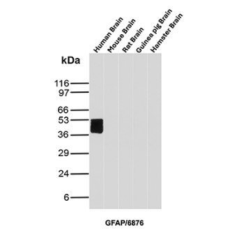 Glial Fibrillary Acidic Protein Antibody Brain Tissue WB. Western blot analysis of human brain, mouse brain, rat brain, guinea pig brain, and hamster brain tissue lysates using Glial fibrillary acidic protein Antibody clone GFAP/6876. A strong band is detected at approximately 50 kDa in human brain lysate, consistent with the predicted molecular weight of GFAP, an astrocyte-associated intermediate filament protein involved in cytoskeletal organization and maintenance of neural tissue architecture. Subtle lower molecular weight bands forming a stacked pattern beneath the primary signal likely represent GFAP isoforms and/or partial proteolytic processing products commonly observed in brain-derived tissue lysates.