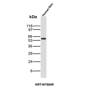 Cytokeratin 10 Antibody KRT10/7804R by WB in Skin Tissue Lysate. Western blot analysis of skin tissue lysate using Cytokeratin 10 Antibody KRT10/7804R. A prominent immunoreactive band is detected at approximately 60 kDa, consistent with the expected molecular weight of cytokeratin 10. The CK10 Rabbit Monoclonal Antibody demonstrates detection of endogenous KRT10 in skin tissue, where this intermediate filament protein is expressed predominantly in differentiated suprabasal keratinocytes.