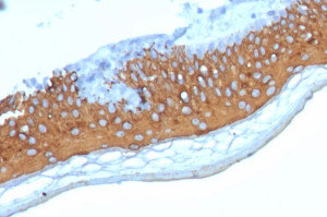 Cytokeratin 10 Antibody KRT10/7804R by IHC in Human Skin. Immunohistochemistry of FFPE human skin tissue using Cytokeratin 10 Antibody KRT10/7804R at 2 ug/ml. Strong brown cytoplasmic staining is observed throughout the suprabasal epidermal layers, while the basal cell layer exhibits comparatively weak staining. The CK10 Rabbit Monoclonal Antibody highlights differentiated keratinocytes, consistent with the normal distribution of KRT10 in stratified squamous epithelium. Nuclei are counterstained blue with hematoxylin. Heat-induced epitope retrieval was performed using 10 mM Tris with 1 mM EDTA, pH 9, for 20 minutes.