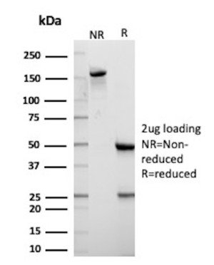Cytokeratin 10 Antibody KRT10/7804R by SDS-PAGE. SDS-PAGE analysis of purified Cytokeratin 10 Antibody KRT10/7804R under non-reducing (NR) and reducing (R) conditions, with 2 ug of antibody loaded per lane. The non-reducing lane shows a prominent band migrating at approximately 150 kDa, consistent with intact IgG. Under reducing conditions, distinct bands are observed at approximately 50 kDa and 25 kDa, corresponding to the immunoglobulin heavy and light chains, respectively. The CK10 Rabbit Monoclonal Antibody demonstrates the expected electrophoretic profile of a purified rabbit IgG preparation.