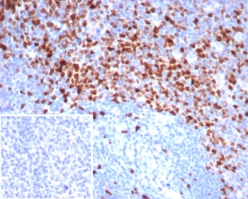 Topoisomerase II alpha Antibody / DNA Decatenation Enzyme Antibody (clone TOP2A/7169R). Immunohistochemistry analysis of FFPE human tonsil tissue demonstrates strong nuclear staining of DNA Topoisomerase II alpha in proliferating lymphoid cells. Nuclear immunoreactivity is most prominent within germinal center lymphocytes, reflecting elevated expression of this DNA decatenation enzyme in rapidly dividing immune cells. As a DNA Decatenation Enzyme Antibody, clone TOP2A/7169R highlights cells in which DNA Topoisomerase II alpha catalyzes DNA decatenation, resolving DNA catenanes generated during DNA replication and enabling proper chromatid separation during cell division. Inset: PBS used in place of primary antibody as a negative control. HIER: boil tissue sections in pH 9 Tris-EDTA buffer for 20 min followed by cooling at RT prior to immunohistochemistry staining.