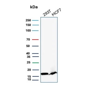 Western blot testing of human 293T and MCF-7 cell lysate with NME2 antibody (clone NME2/6435). Predicted molecular weight ~17 kDa.