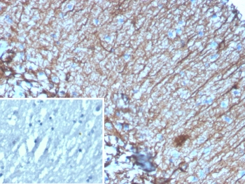 IHC staining of FFPE human brain tissue with GFAP antibody (clone GFAP/6878). Inset: PBS used in place of primary Ab (secondary Ab negative control). HIER: boil tissue sections in pH 9 10mM Tris with 1mM EDTA for 20 min and allow to cool before testing.