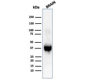 Western blot testing of human brain tissue lysate with GFAP antibody (clone GFAP/6878).