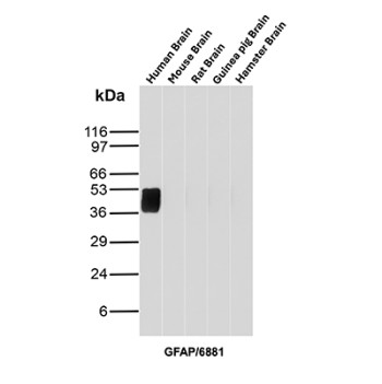 GFAP Antibody Brain Tissue WB. Western blot analysis of human brain, mouse brain, rat brain, guinea pig brain, and hamster brain tissue lysates using GFAP Antibody clone GFAP/6881. A strong band is detected at approximately 50 kDa in human brain lysate, consistent with the predicted molecular weight of Glial fibrillary acidic protein / GFAP, a major astrocytic intermediate filament protein involved in maintenance of neural cytoskeletal structure and central nervous system integrity. Subtle lower molecular weight bands forming a stacked pattern beneath the primary signal likely represent GFAP isoforms and/or partial proteolytic processing products commonly observed in brain tissue extracts.