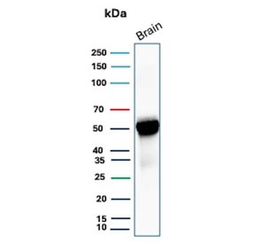 Western blot testing of human brain tissue with GFAP antibody. Predicted molecular weight ~50 kDa.