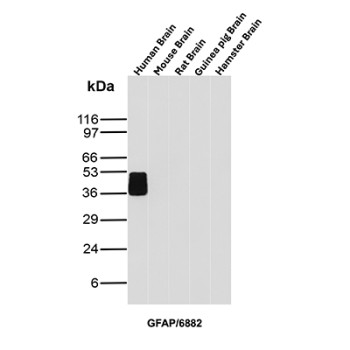 GFAP Antibody Brain Tissue WB. Western blot analysis of human brain, mouse brain, rat brain, guinea pig brain, and hamster brain tissue lysates using GFAP Antibody clone GFAP/6882. A strong band is detected at approximately 50 kDa in human brain lysate, consistent with the predicted molecular weight of Glial fibrillary acidic protein / GFAP, an astrocyte-associated intermediate filament protein involved in maintenance of neural cytoskeletal organization and central nervous system structural integrity. Multiple faint lower molecular weight bands forming a subtle stacked pattern beneath the primary signal likely represent GFAP isoforms and/or partial proteolytic processing products commonly observed in brain-derived tissue lysates.