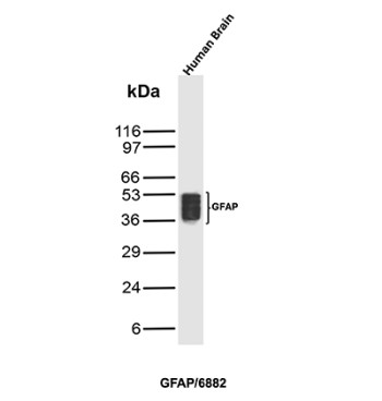 GFAP Antibody Human Brain WB. Western blot analysis of human brain tissue lysate using GFAP Antibody clone GFAP/6882. Multiple closely migrating bands are detected between approximately 40-50 kDa, consistent with Glial fibrillary acidic protein / GFAP and related lower molecular weight species commonly observed in brain tissue extracts. The stacked banding pattern likely reflects a combination of GFAP isoforms and partial proteolytic processing products associated with astrocytic intermediate filament remodeling in neural tissue.