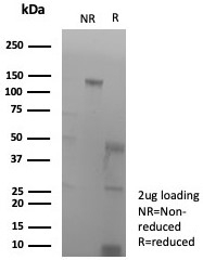 SDS-PAGE analysis of purified, BSA-free recombinant PECAM antibody (clone rPECAM1/8826) as confirmation of integrity and purity.