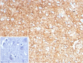 IHC staining of FFPE human brain tissue with GFAP antibody (clone GFAP/8616R). Inset: PBS used in place of primary Ab (secondary Ab negative control). HIER: boil tissue sections in pH 9 10mM Tris with 1mM EDTA for 20 min and allow to cool before testing.